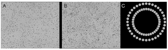 Preparation method and application of liposomes of shikonin and derivatives or modifiers thereof