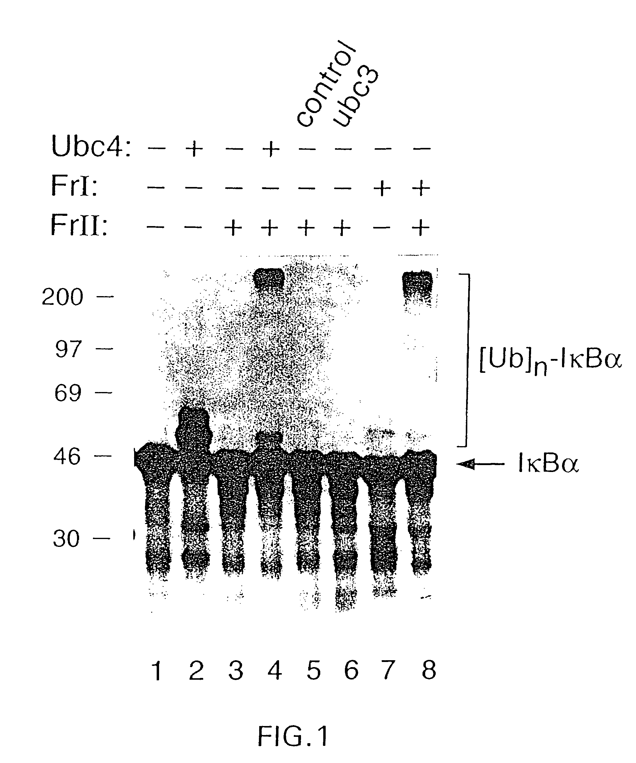 Antibody to a kinase capable of site-specific phosphorylation of IkappaBalpha