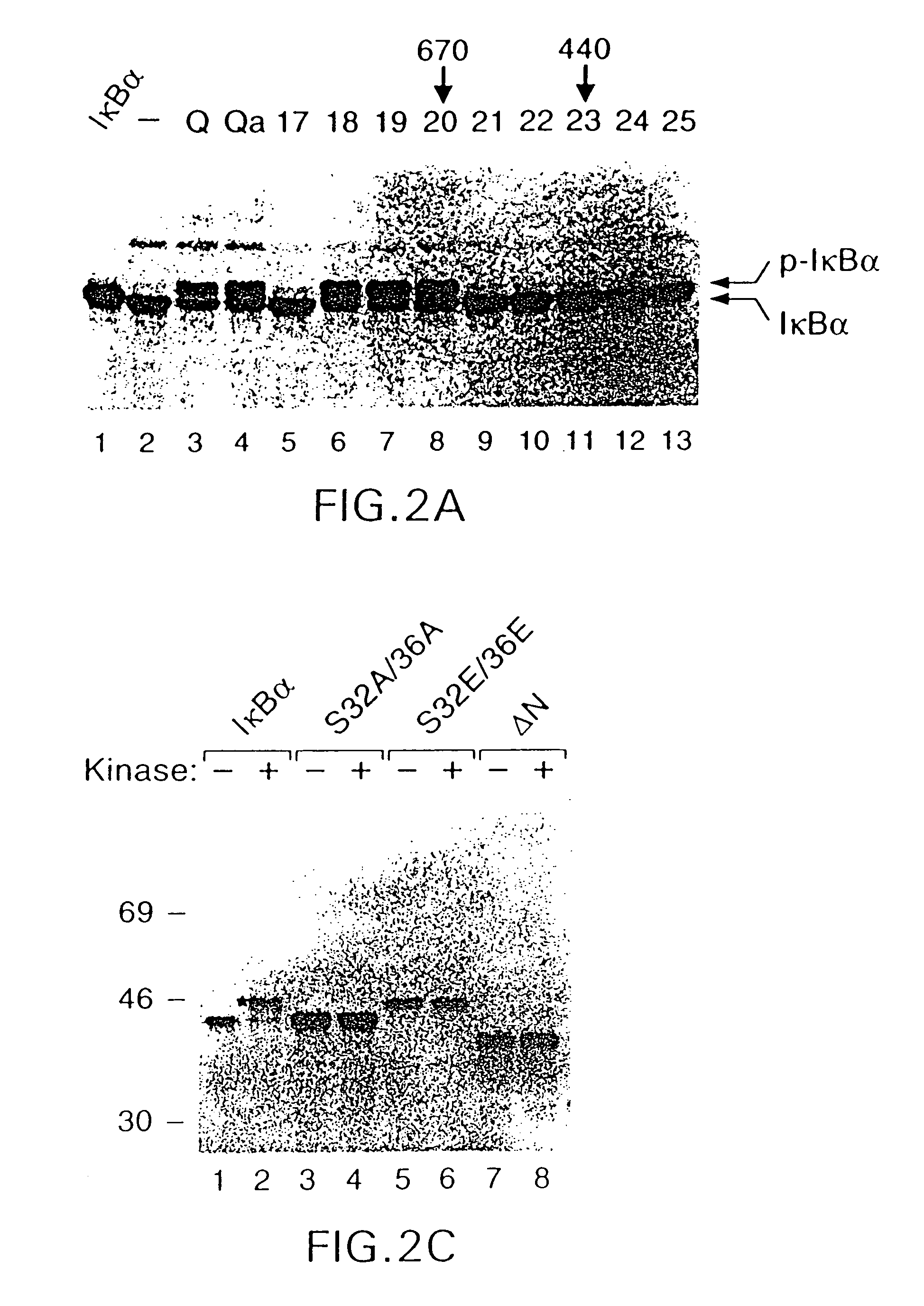 Antibody to a kinase capable of site-specific phosphorylation of IkappaBalpha