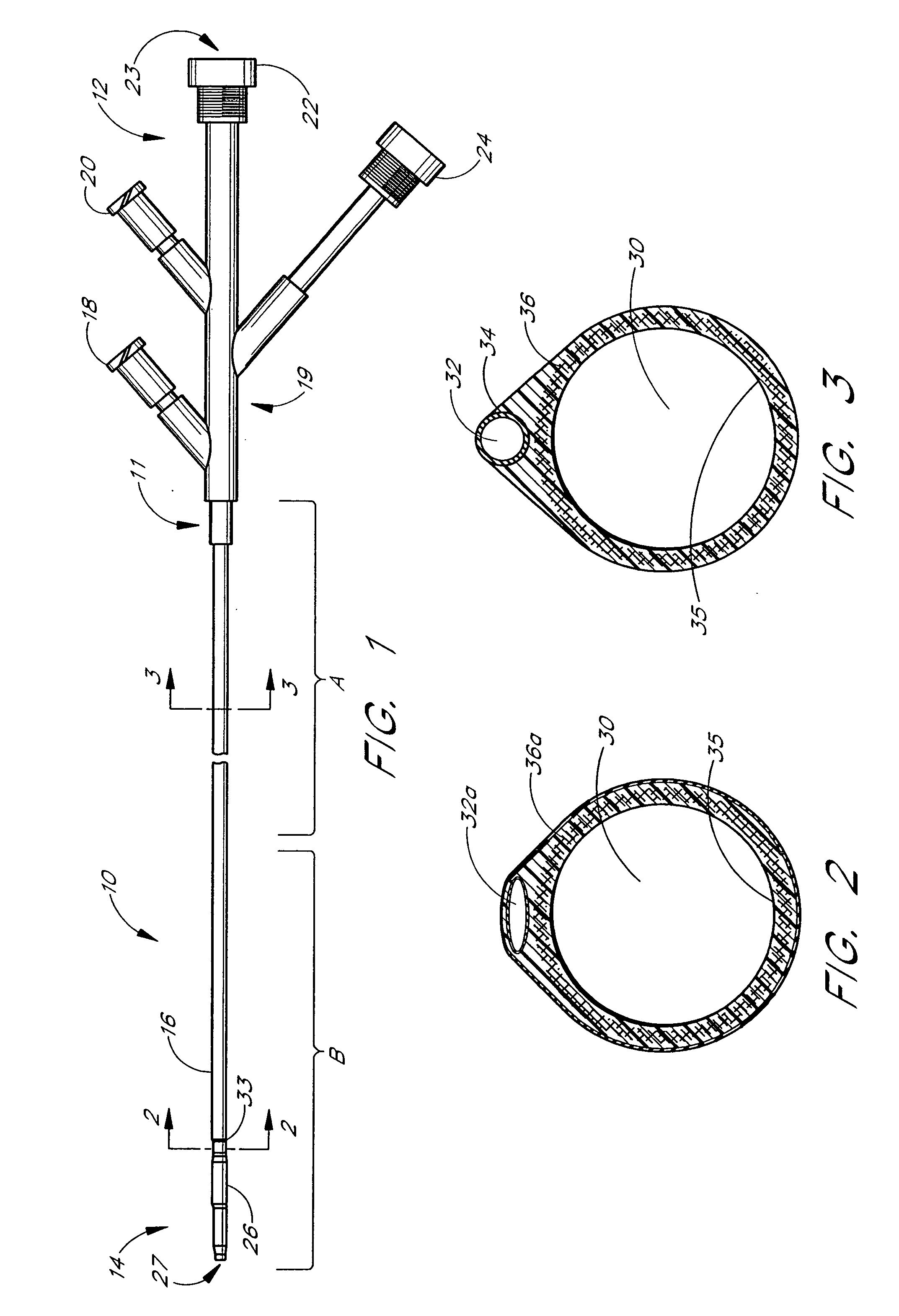 Method and apparatus for emboli containment