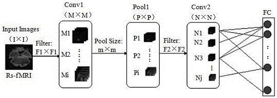 Magnetic resonance image feature extraction and classification method based on deep learning