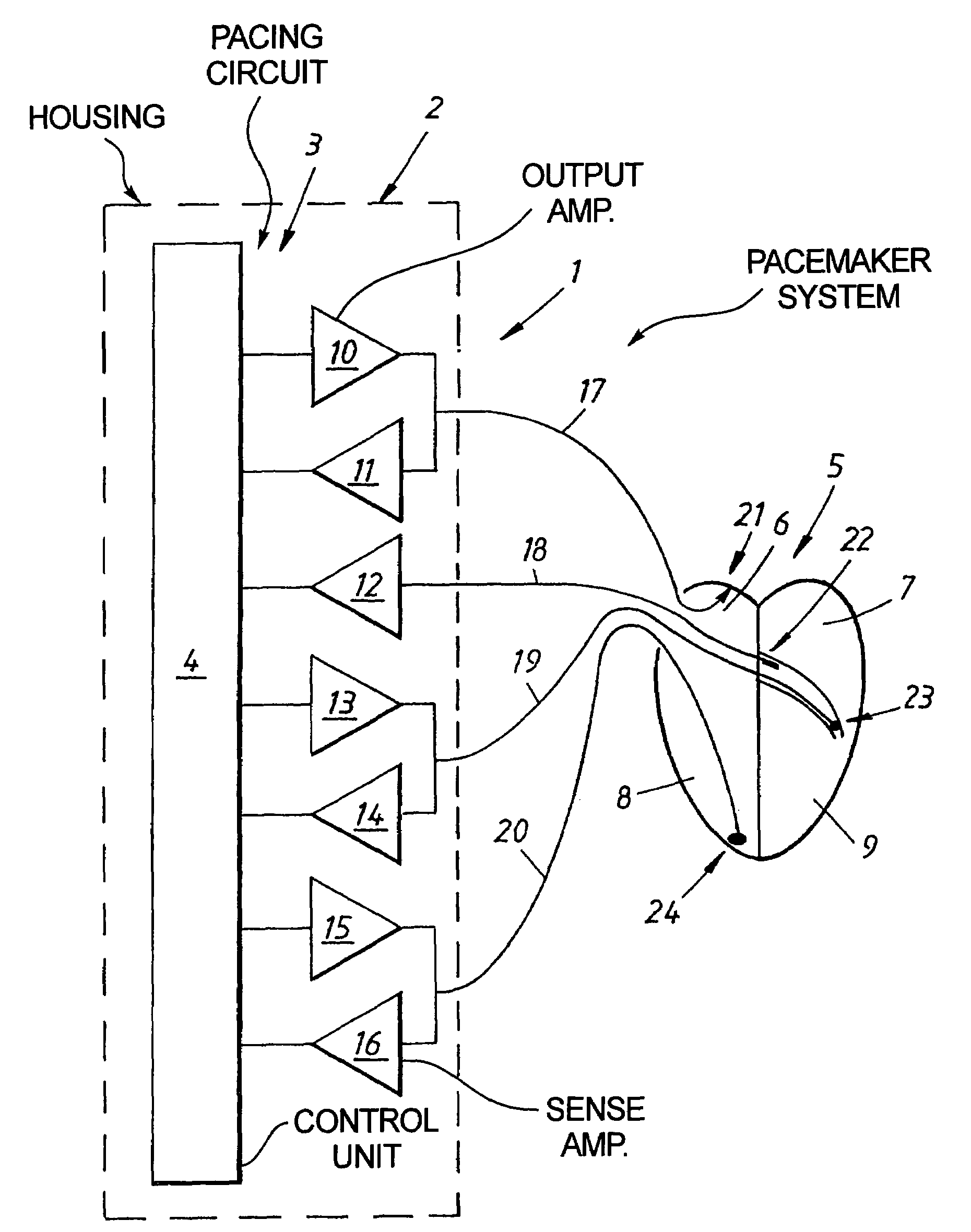 Cardiac stimulating device