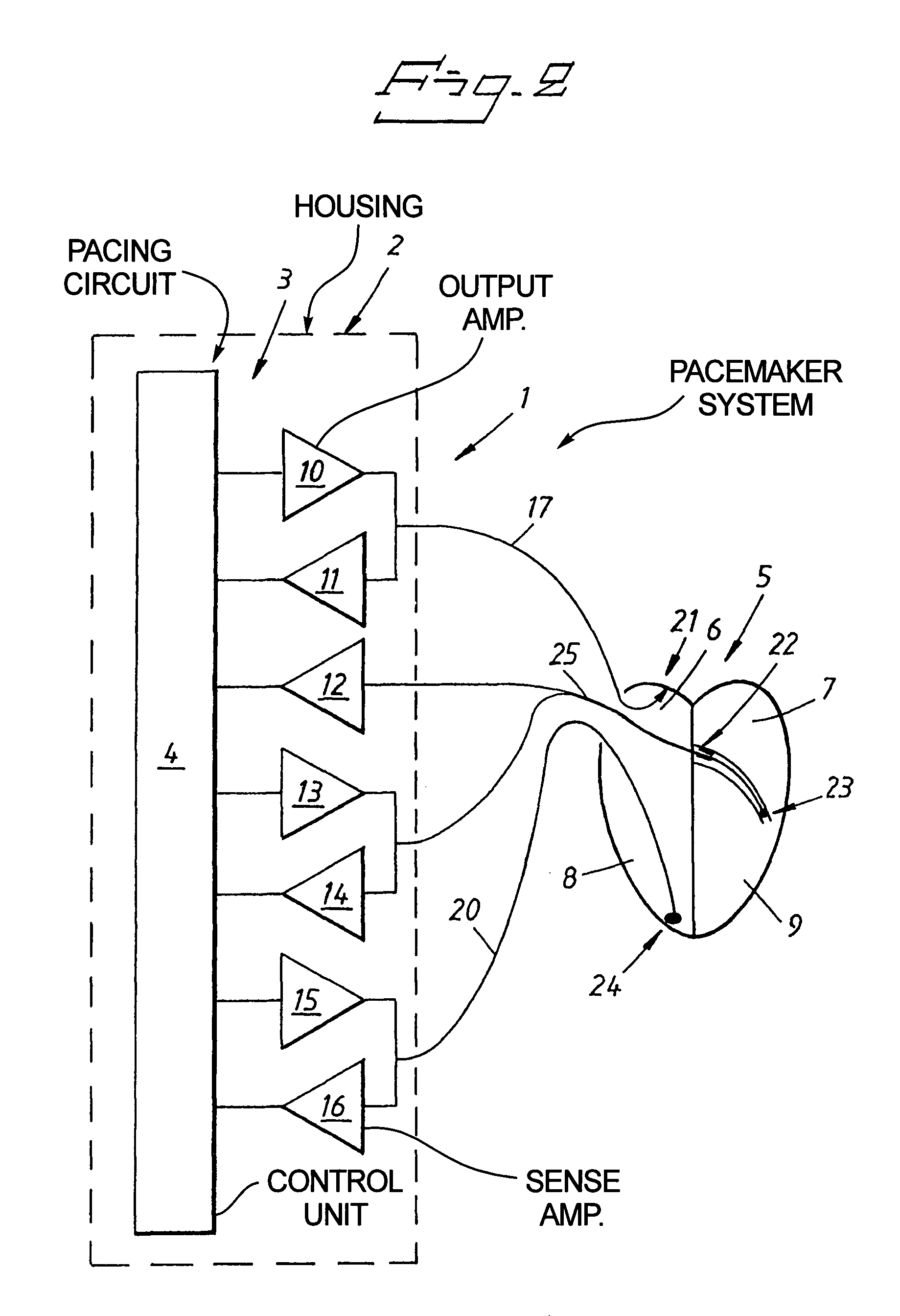 Cardiac stimulating device