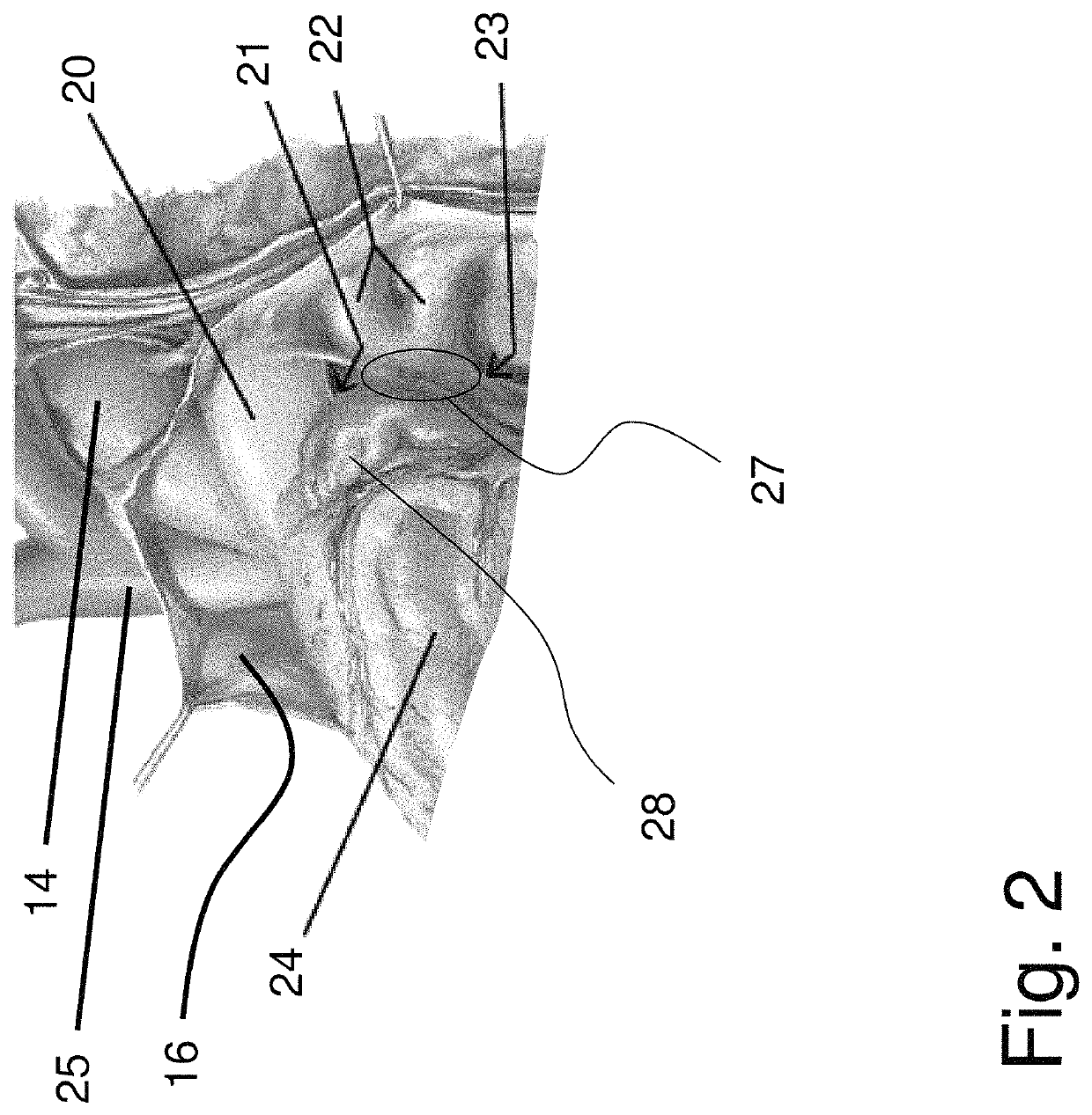 Shaped epicardial lead and placement system and method