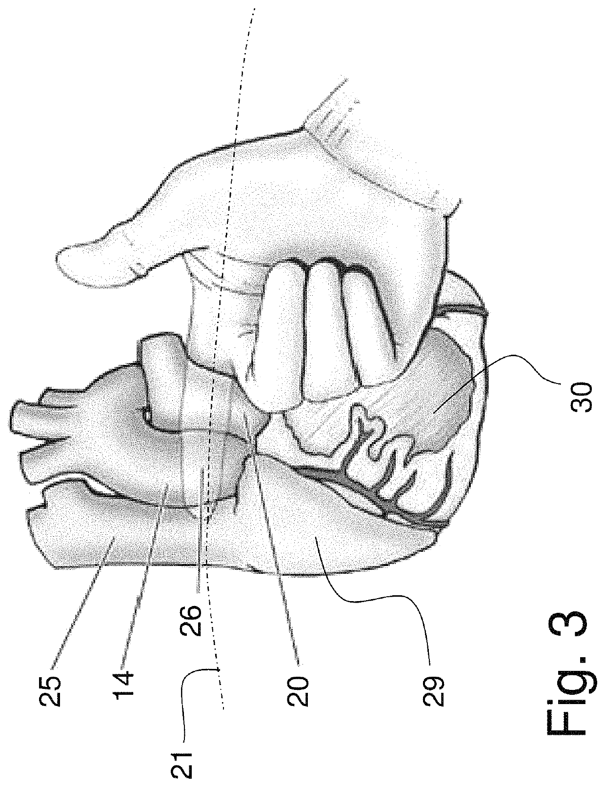 Shaped epicardial lead and placement system and method