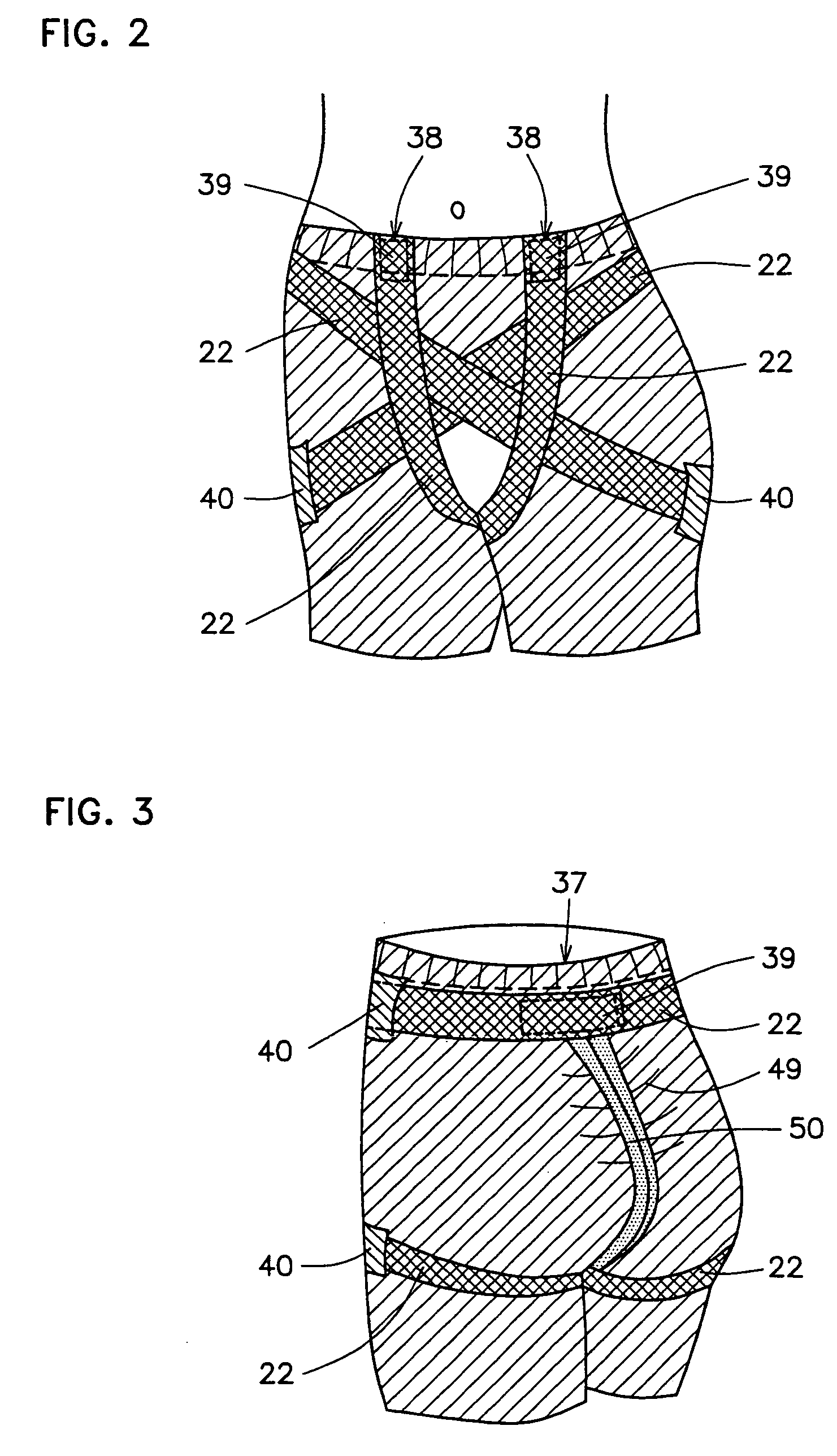 Controlling undergarment