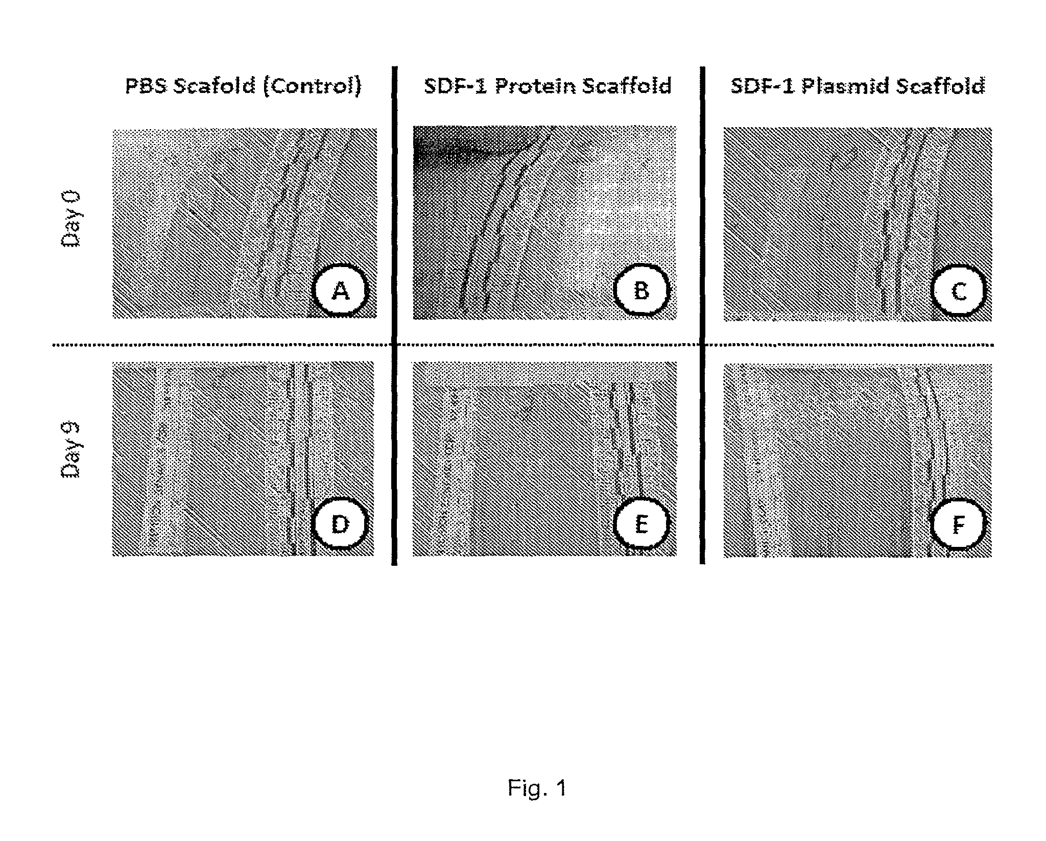 Use of SDF-1 to mitigate scar formation