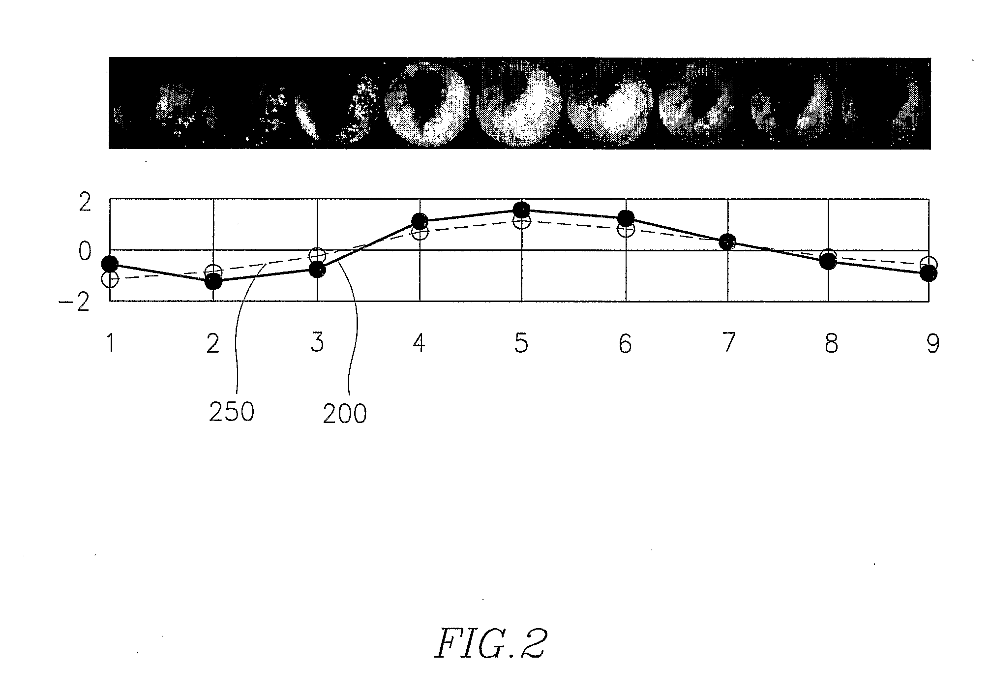 Cascade analysis for intestinal contraction detection