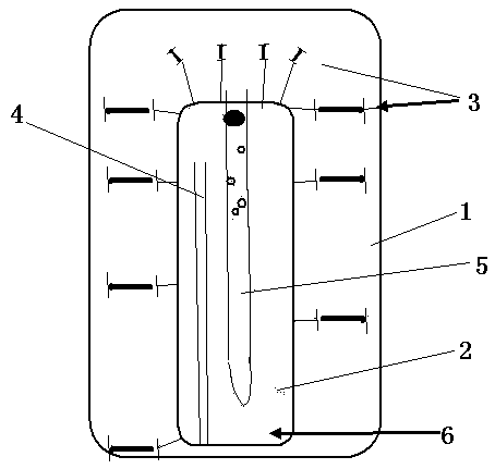 Simple abdomen opening therapy device