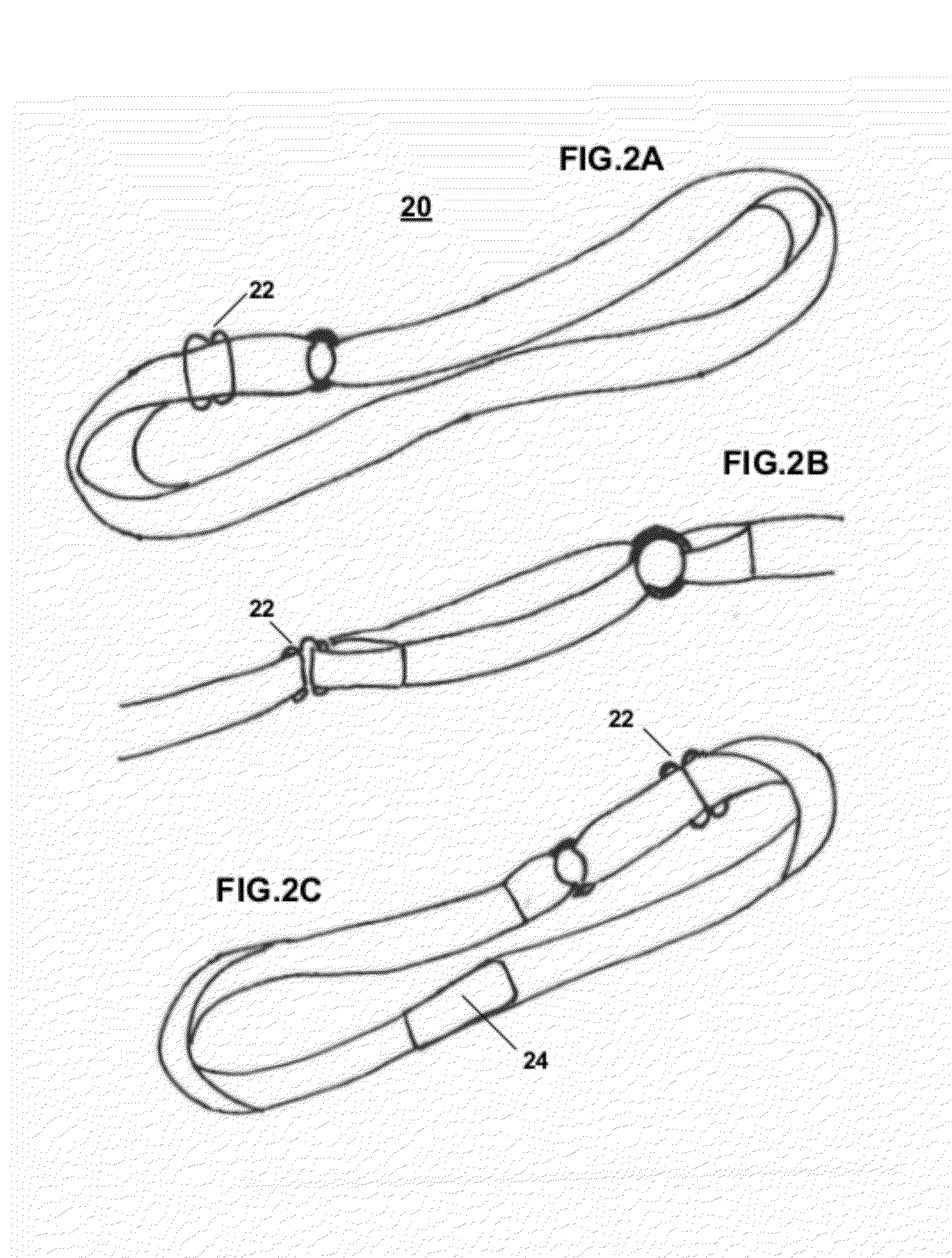 Modular Upper Extremity Support System