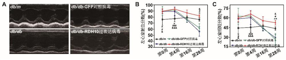 Application of RDH10 and/or prodrug thereof in preparation of medicine for treating and/or preventing diabetic myocardial injury