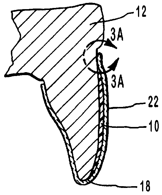 Methods for making scalloped dental trays for use in treating teeth with sticky dental compositions