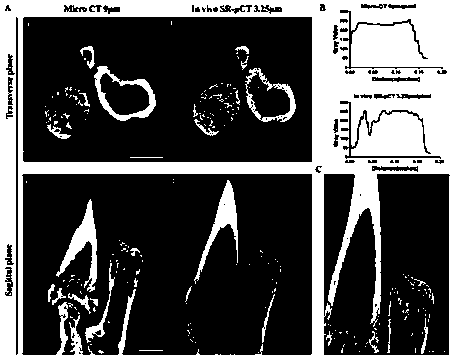 Synchrotron radiation X-ray microscopic CT suitable for imaging of living small animal limbs and fixing device