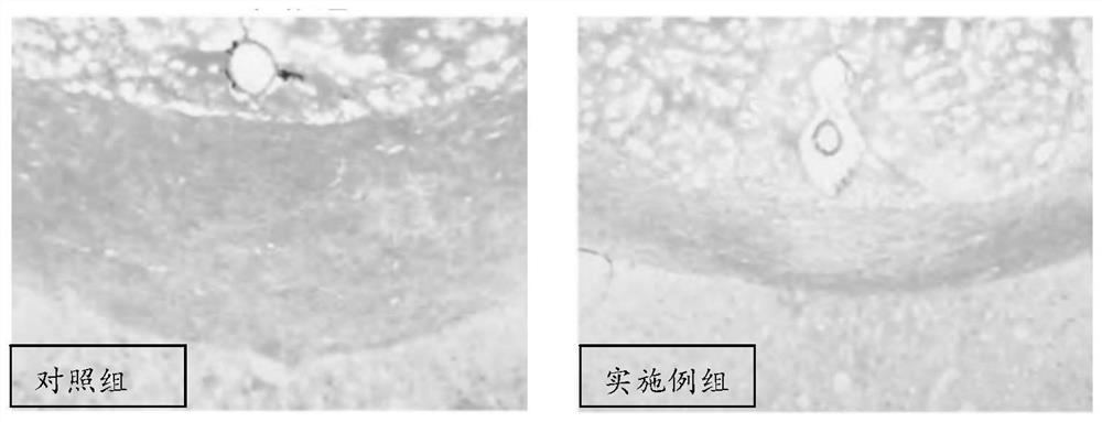 Mouse myelin depletion model feed and preparation method and application thereof