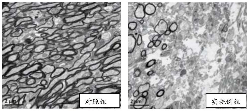 Mouse myelin depletion model feed and preparation method and application thereof