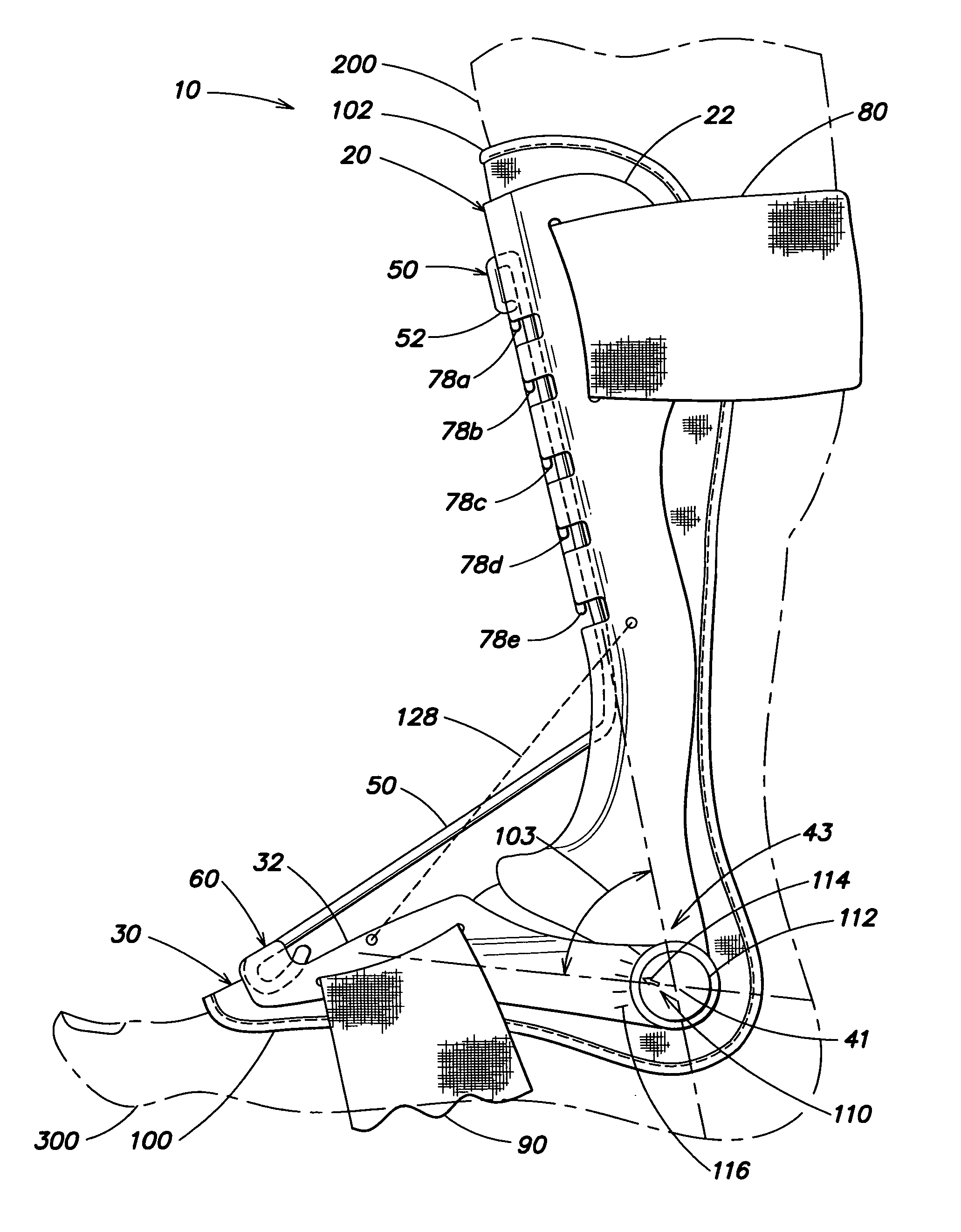 Flexibly adjustable dorsal splint