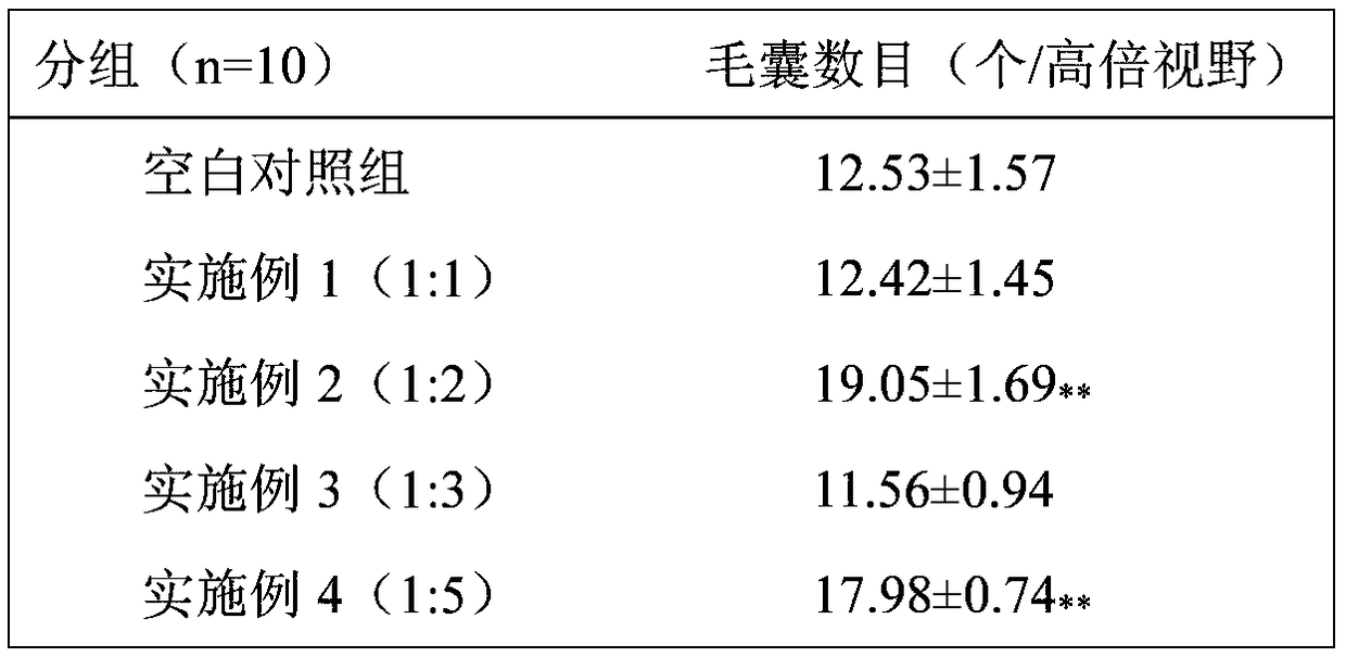 Composition for treating alopecia, preparation method and application thereof