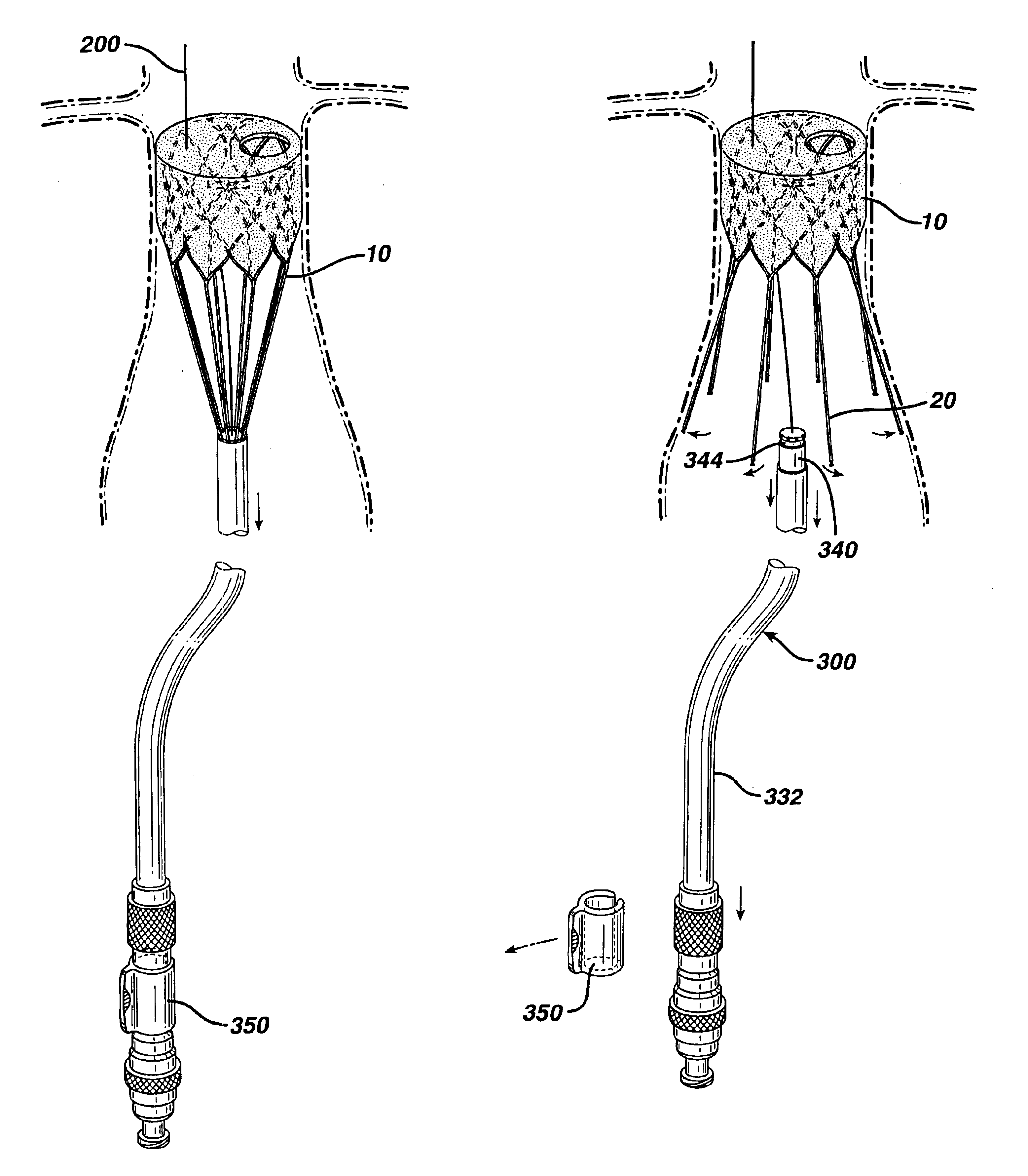 Delivery apparatus for a self expanding retractable stent