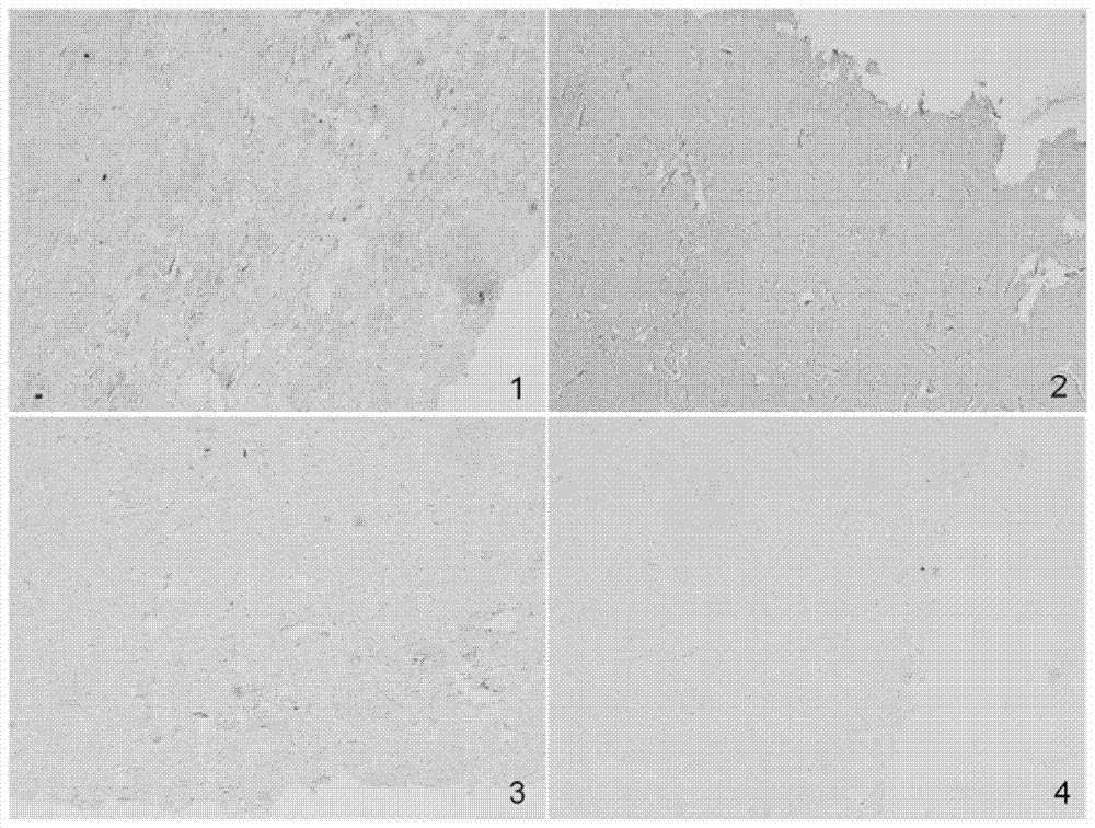 A kind of injectable implant and preparation method thereof