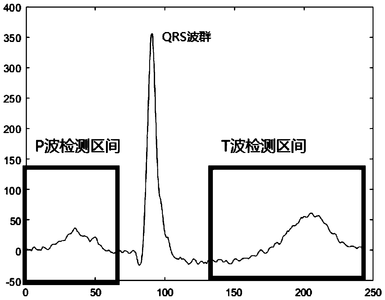 Method for detecting P wave and T wave in ECG signal based on Gaussian function fitting