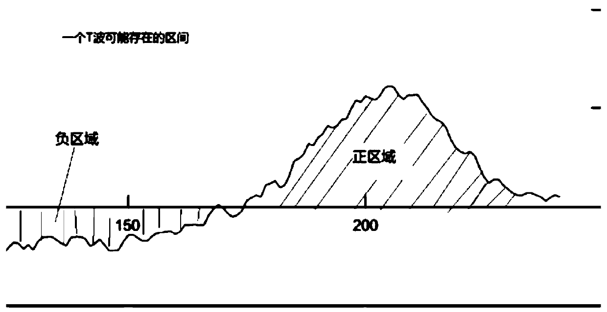 Method for detecting P wave and T wave in ECG signal based on Gaussian function fitting