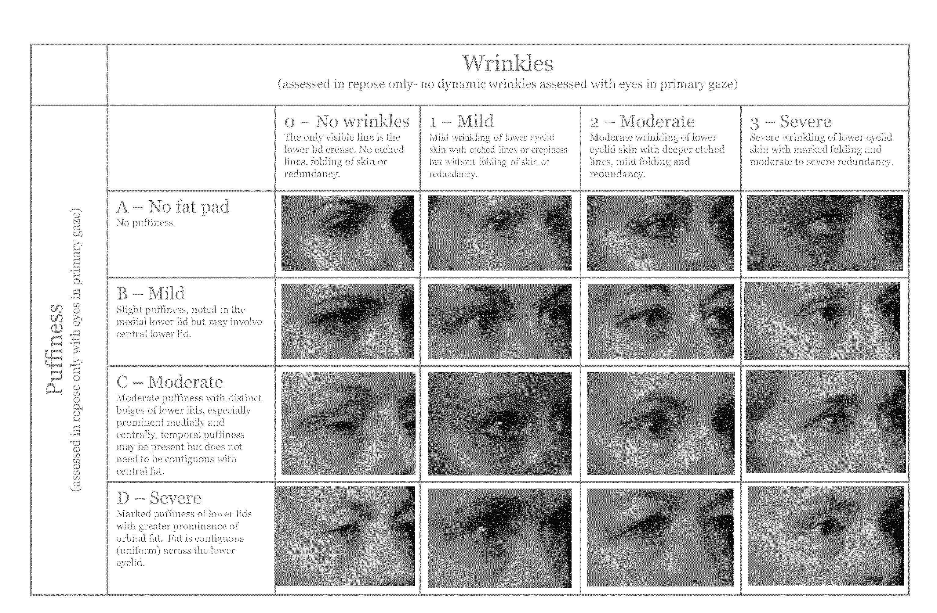 Scale and associated metric for treatment of facial wrinkles and related conditions