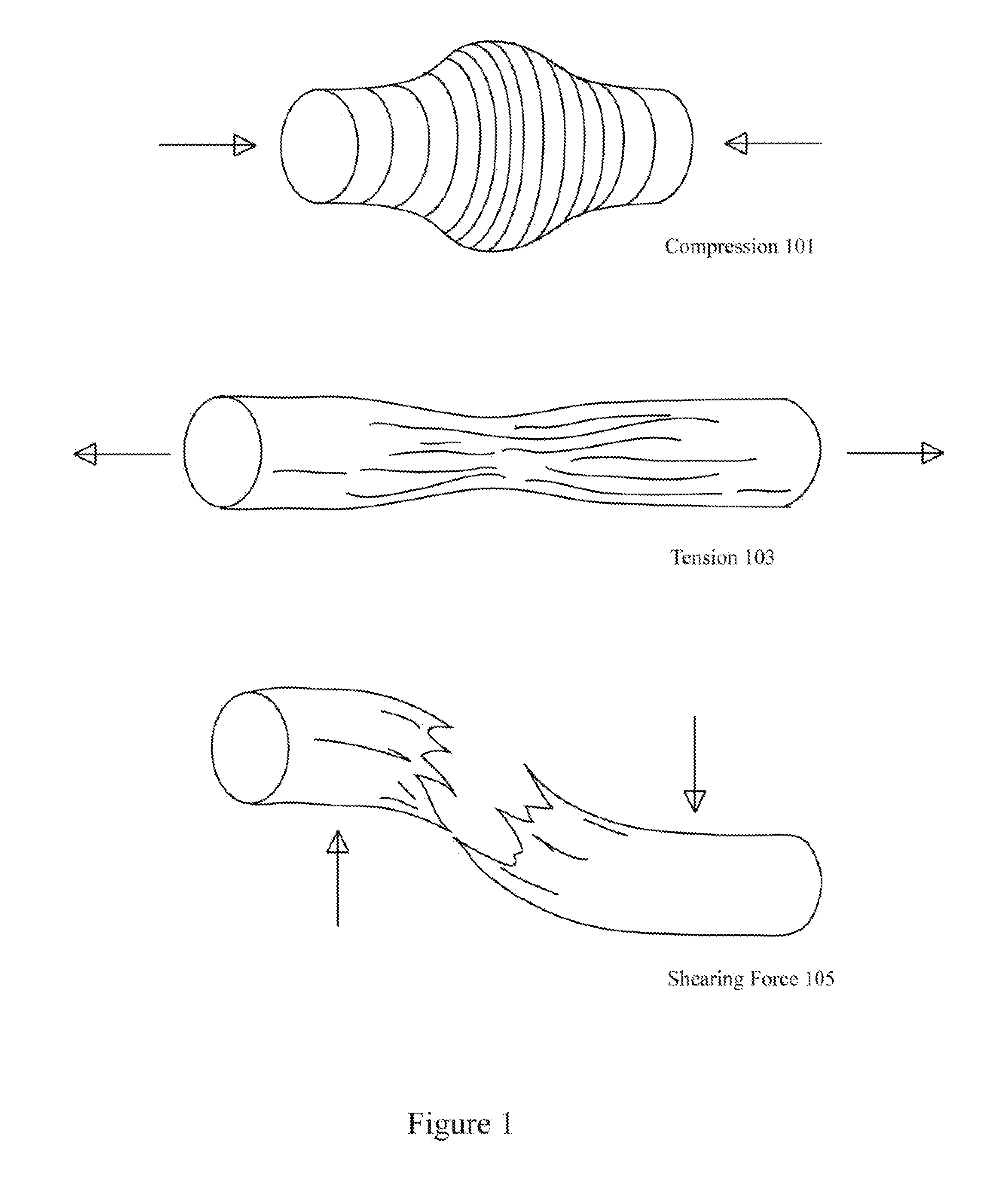 Intelligent protective gear bracing mechanism