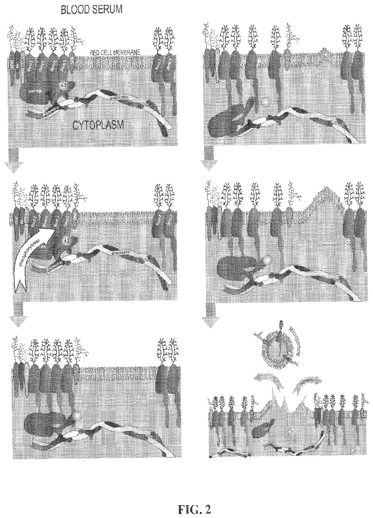 Methods for treating hemolytic diseases and sickle cell disease