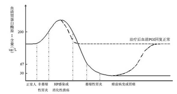 Latex-enhanced immunoturbidimetry kit for measuring Helicobacter pylori antibody as well as preparation method and application thereof