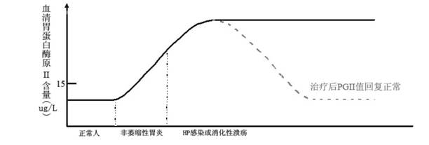 Latex-enhanced immunoturbidimetry kit for measuring Helicobacter pylori antibody as well as preparation method and application thereof