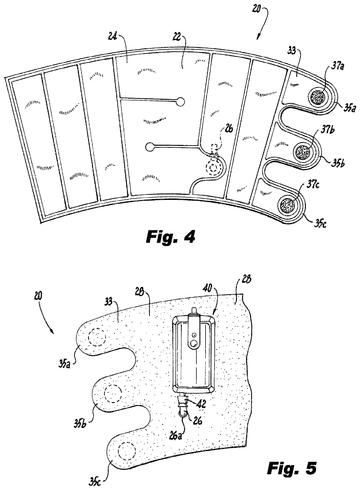 Portable system for the prophylaxis of deep vein thrombosis