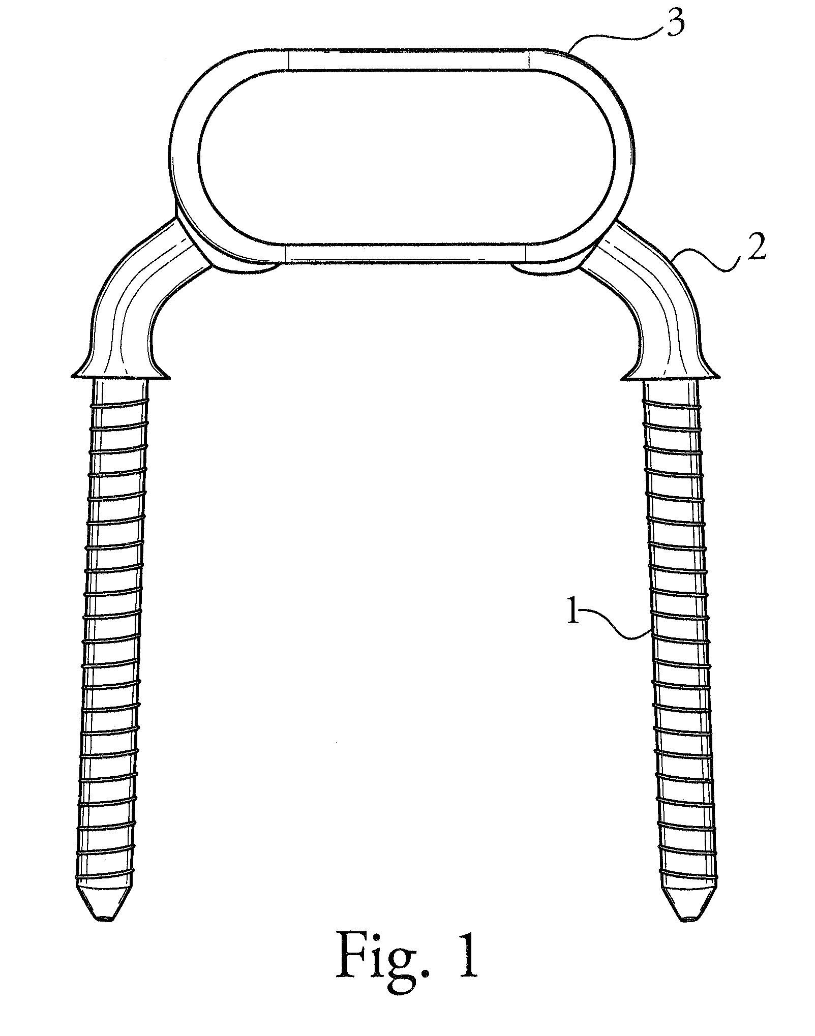 Device and method for implantation that restores physiologic range of motion by establishing an adjustable constrained motion of the spine without intrusion of associated facet joints