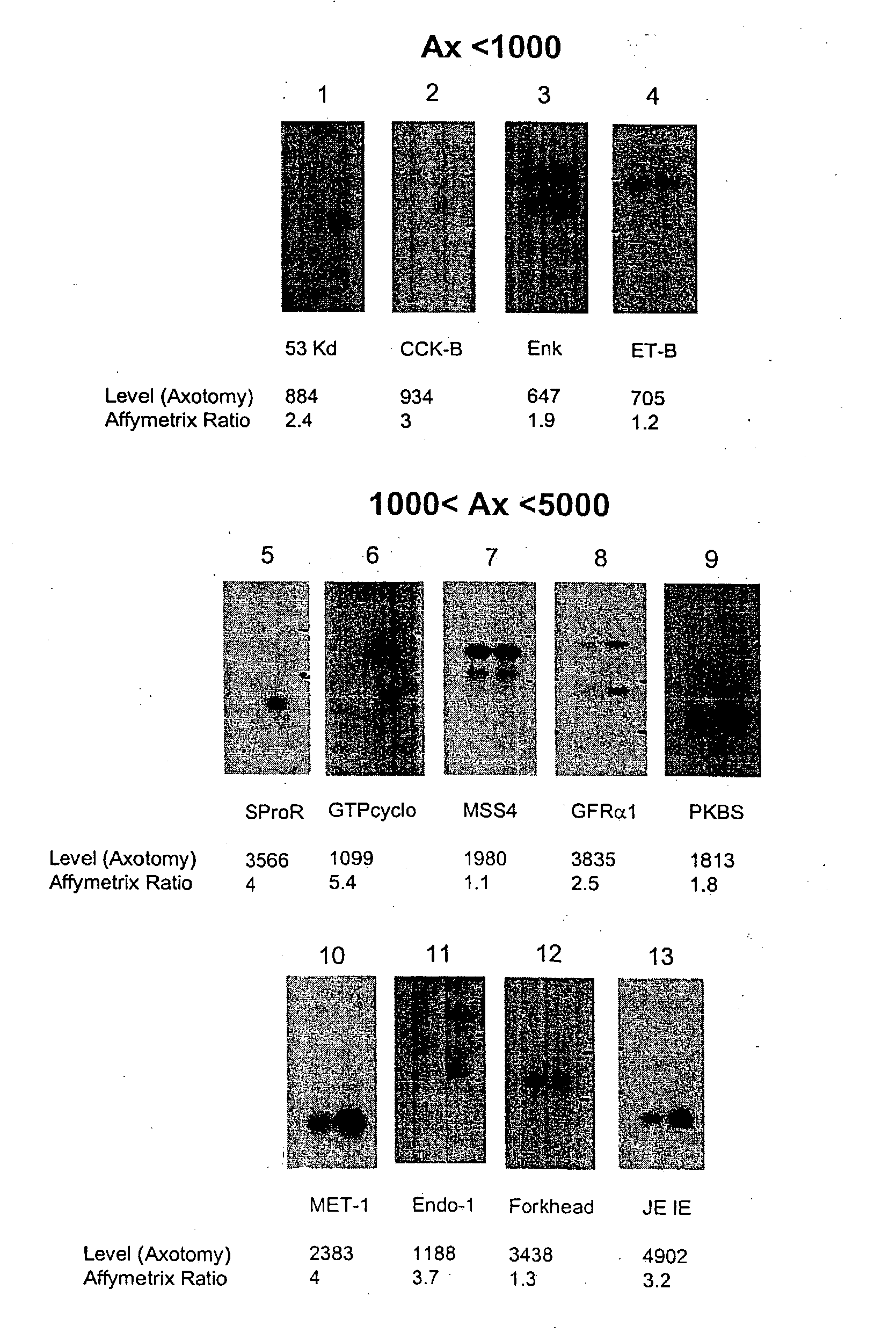 Nucleic acid and amino acid sequences involved in pain