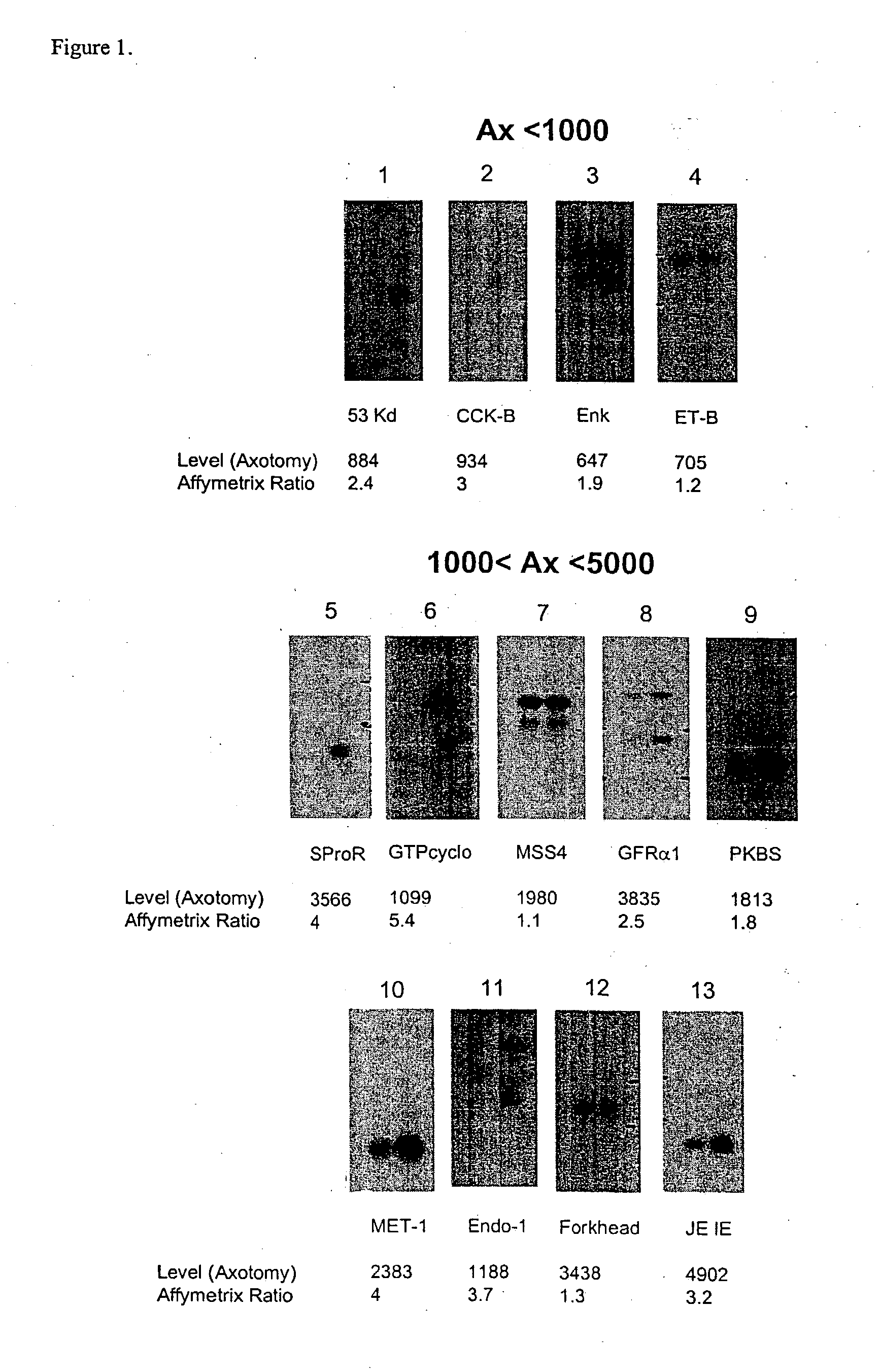 Nucleic acid and amino acid sequences involved in pain