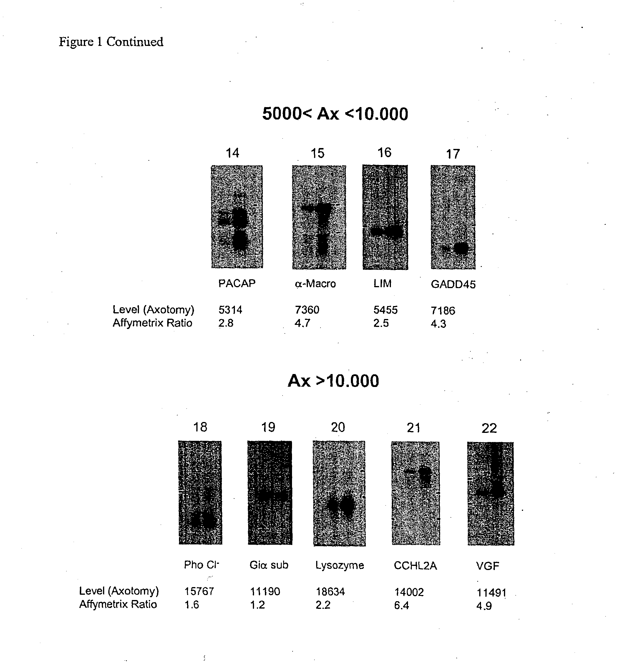 Nucleic acid and amino acid sequences involved in pain