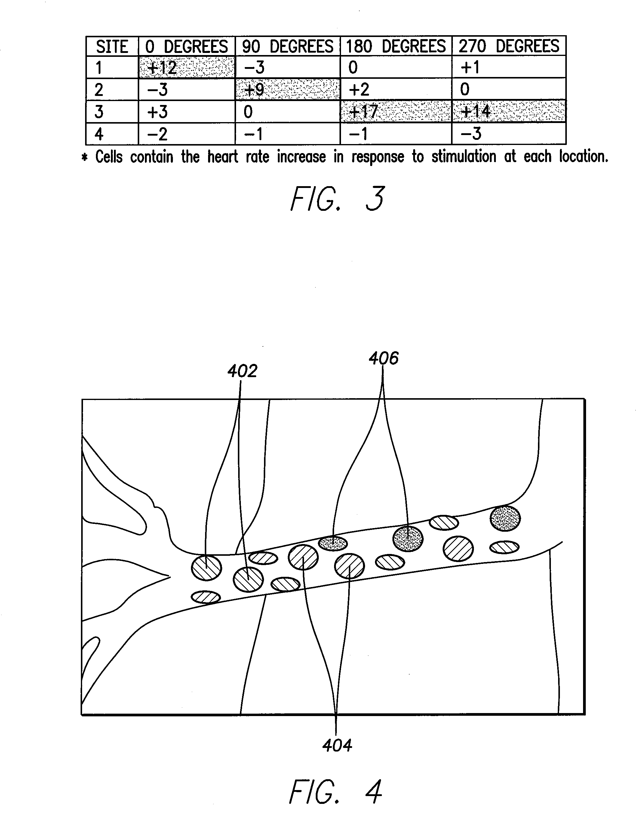 System and method for assessing renal artery nerve density