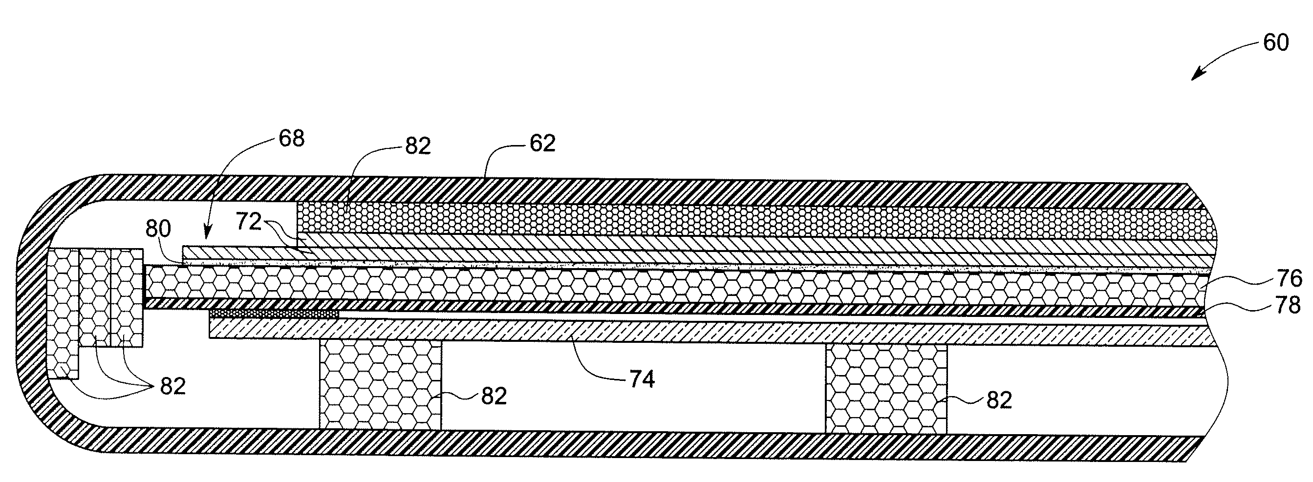 Digital x-ray detectors