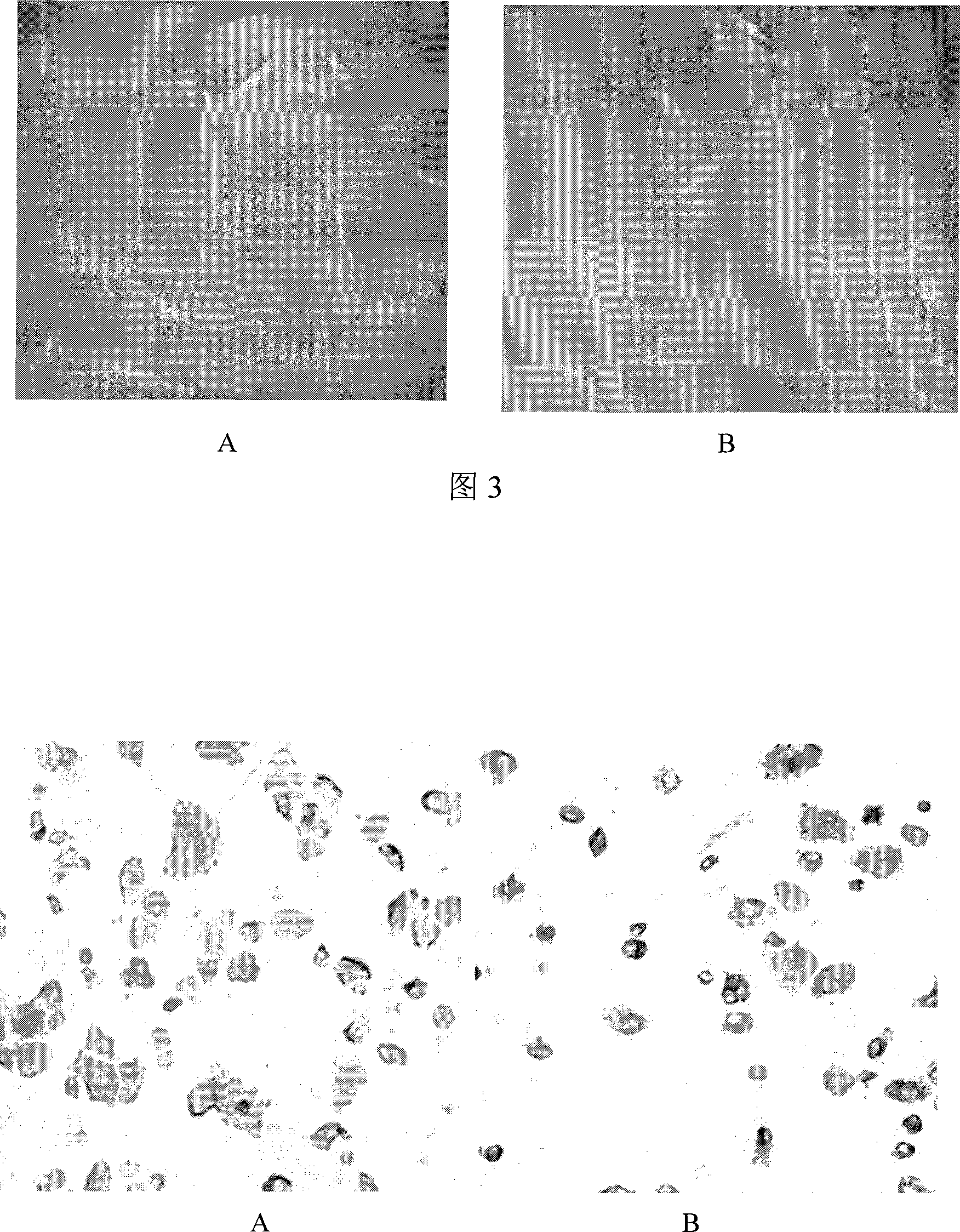 Method for obtaining inner ear hair cell precursor induced by bone marrow mesenchymal stem cells