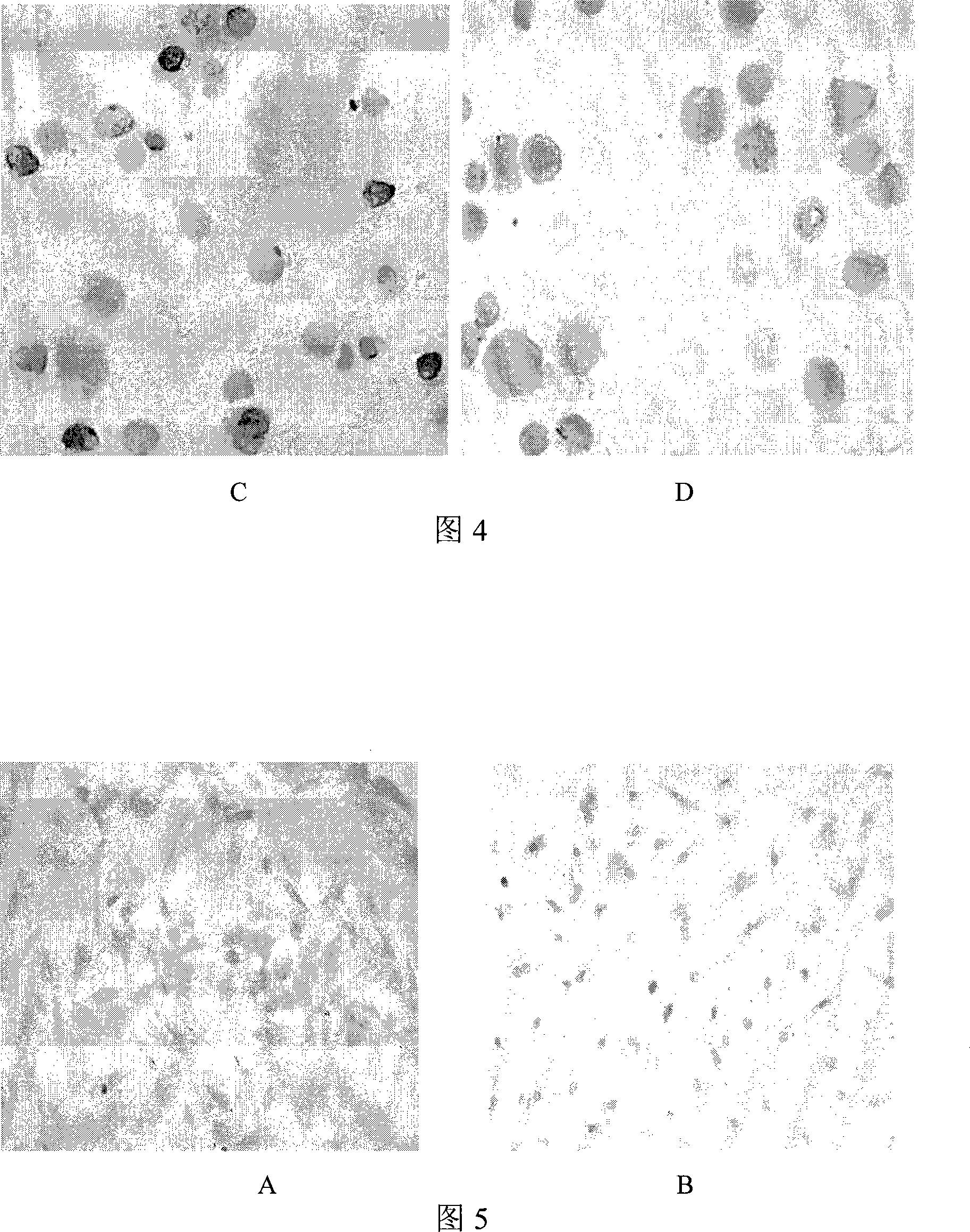 Method for obtaining inner ear hair cell precursor induced by bone marrow mesenchymal stem cells