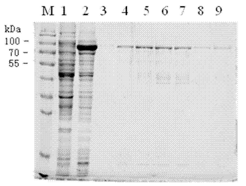 Specific B cell epitope polypeptide of NS1 protein of encephalitis B virus and use thereof