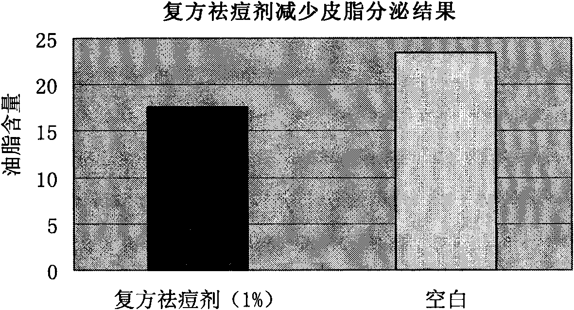 Compound acne-removing Chinese herbal extract and preparation method therefor