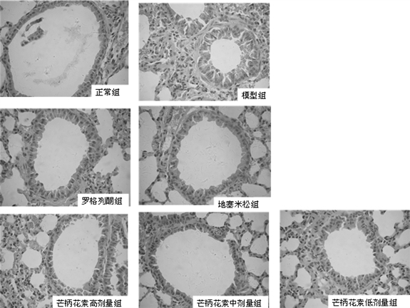 Application of formononetin in preparing medicine for preventing and treating airway inflammation and asthma