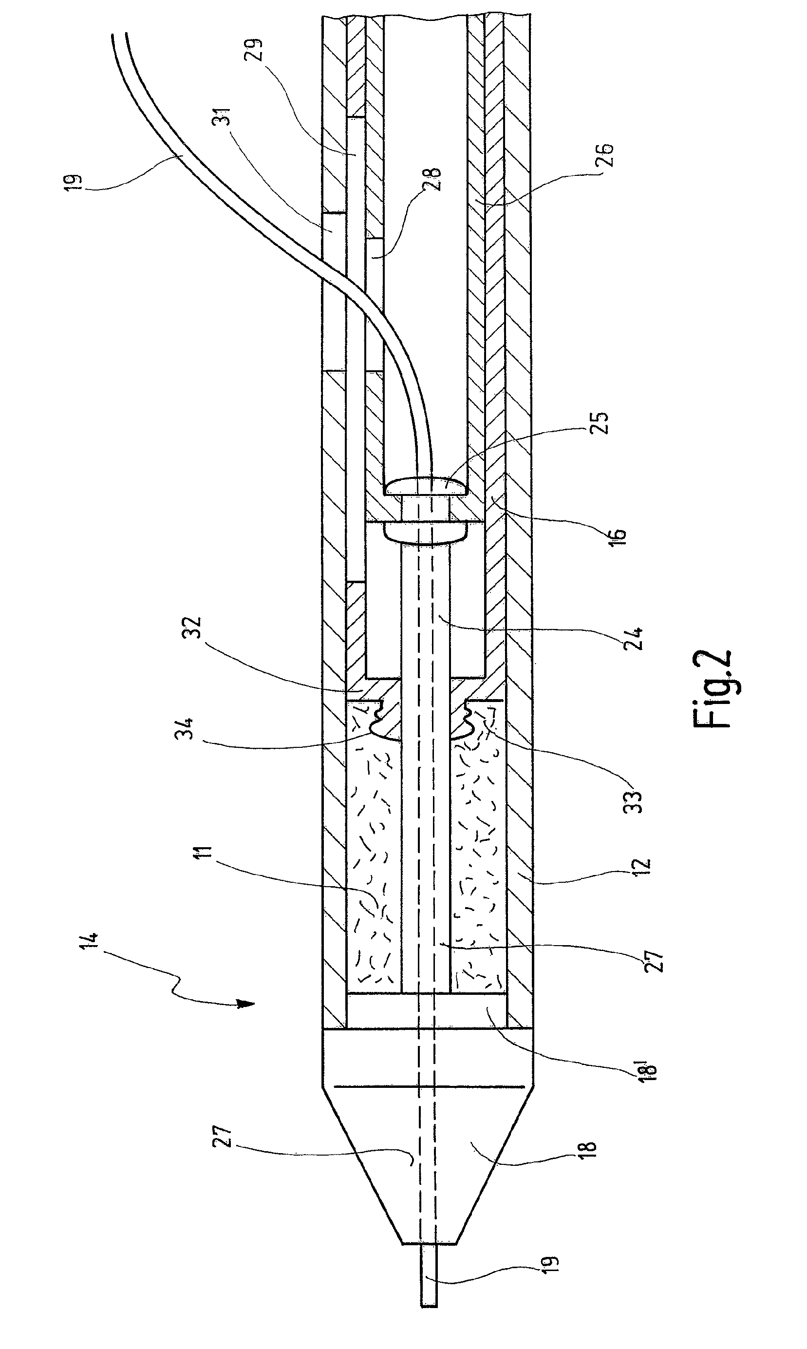 Delivery system having a self-expanding braided stent