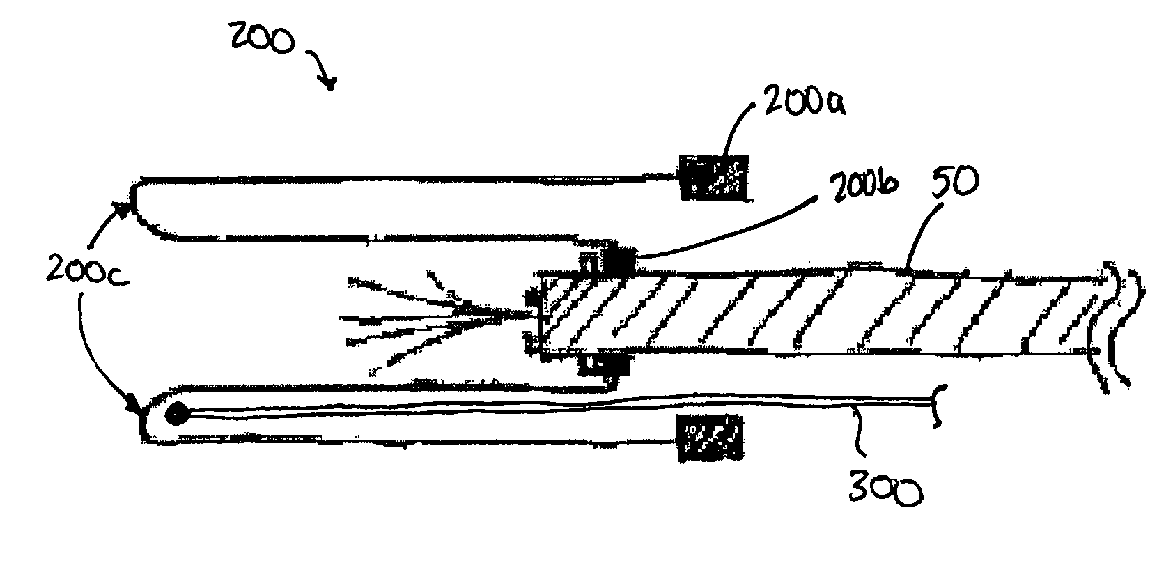 Endoscopic Translumenal Surgical Systems