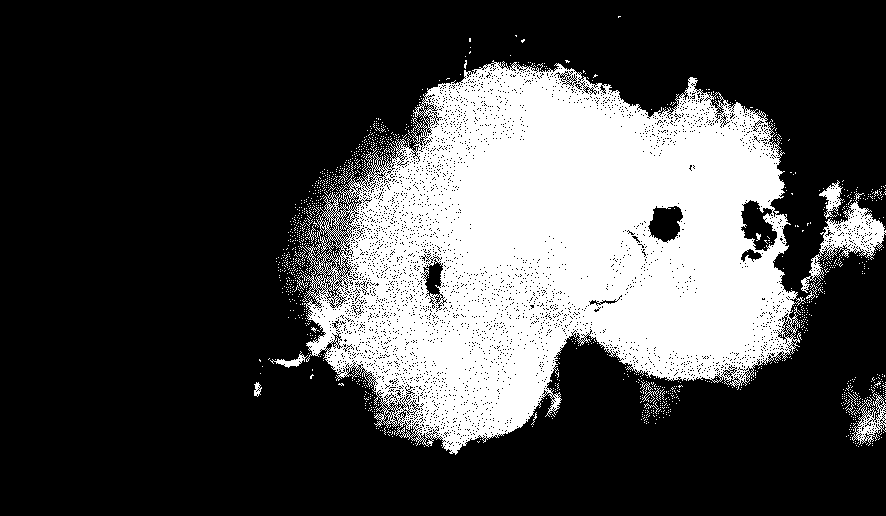 Method for dissecting pupa brain of lepidopteran insect dead by freezing but with undamaged brain