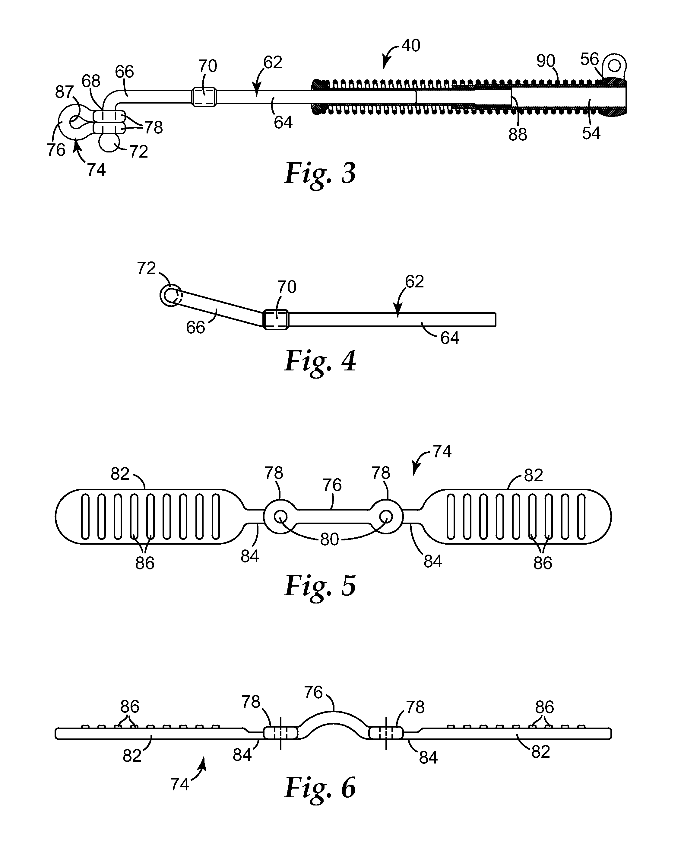 Interarch force module with link for orthodontic treatment