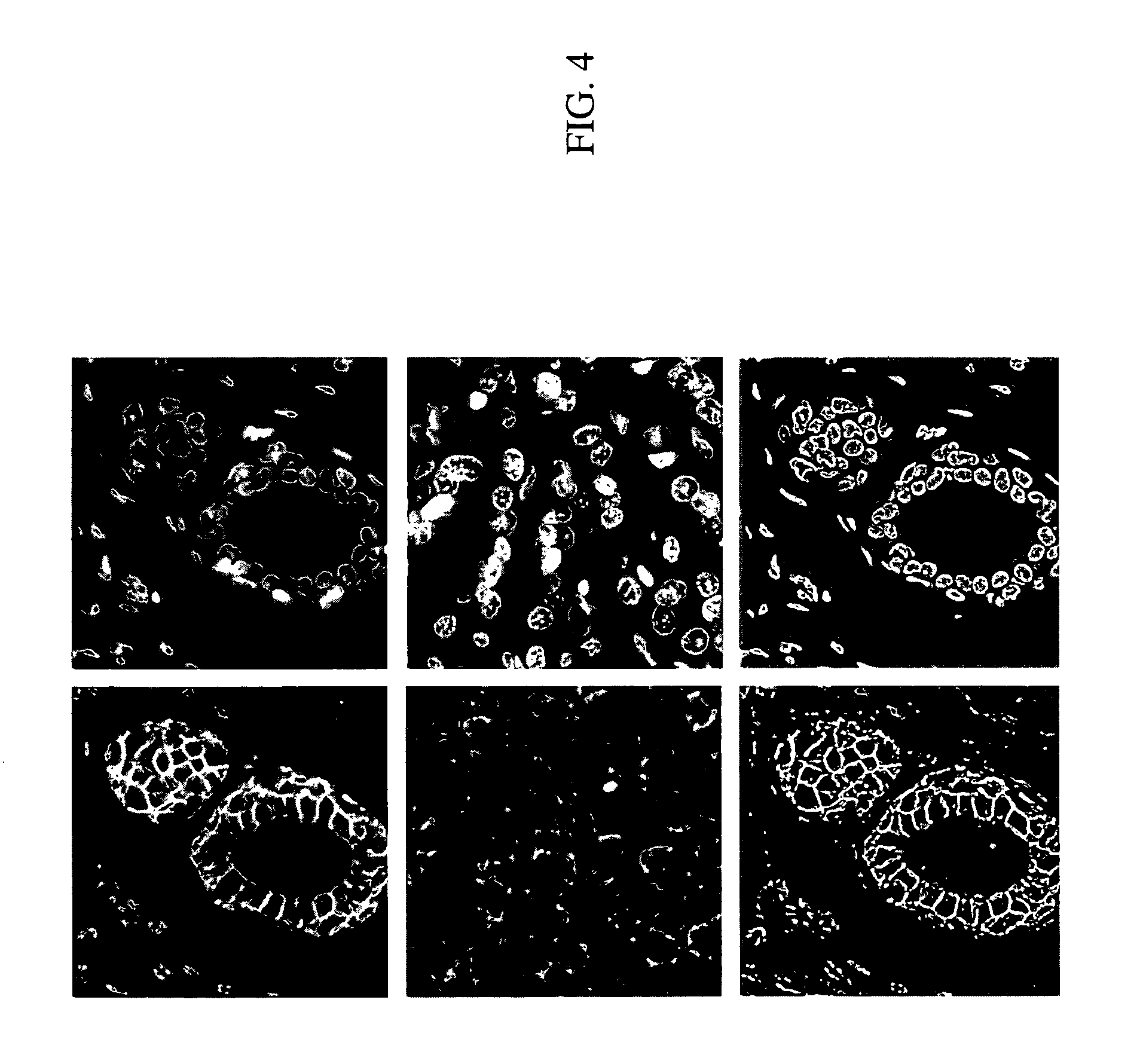 Systems for analyzing tissue samples