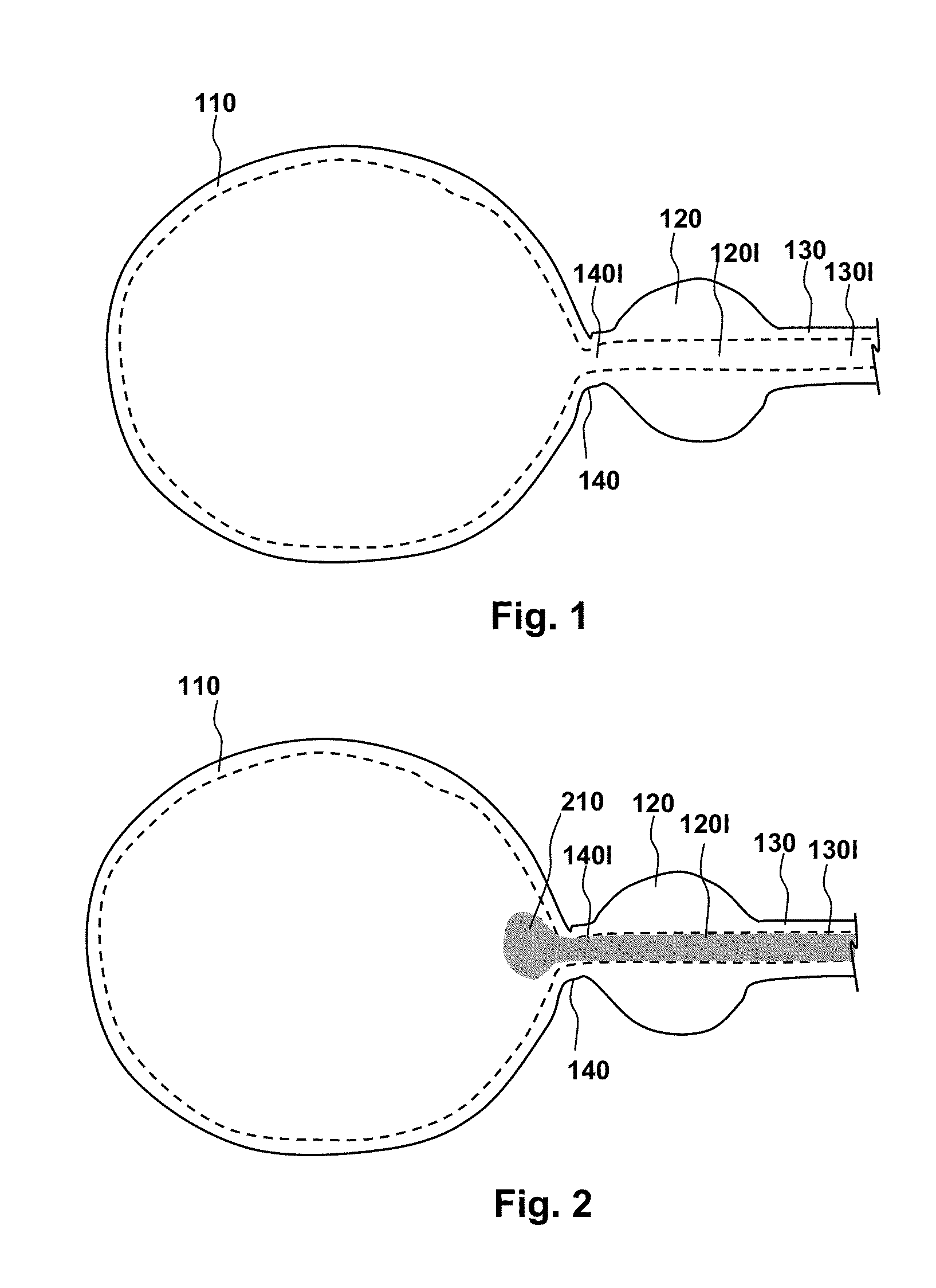 Methods, compositions and kits for performing anastomosis procedures in conjunction with a radical prostatectomy procedure