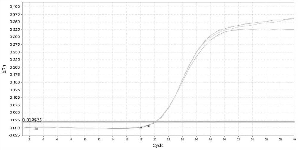 Primer probe group and kit for human leukotriene receptor CysLTR2 mRNA RT-PCR (Reverse Transcription-Polymerase Chain Reaction) detection