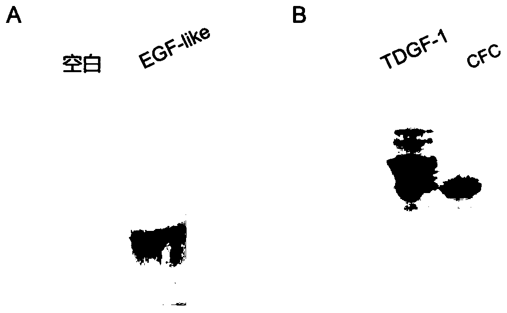 Application of TDGF-1 (teratocarcinoma-derived growth factor-1) truncated micro-molecule polypeptide in anti-hepatic fibrosis